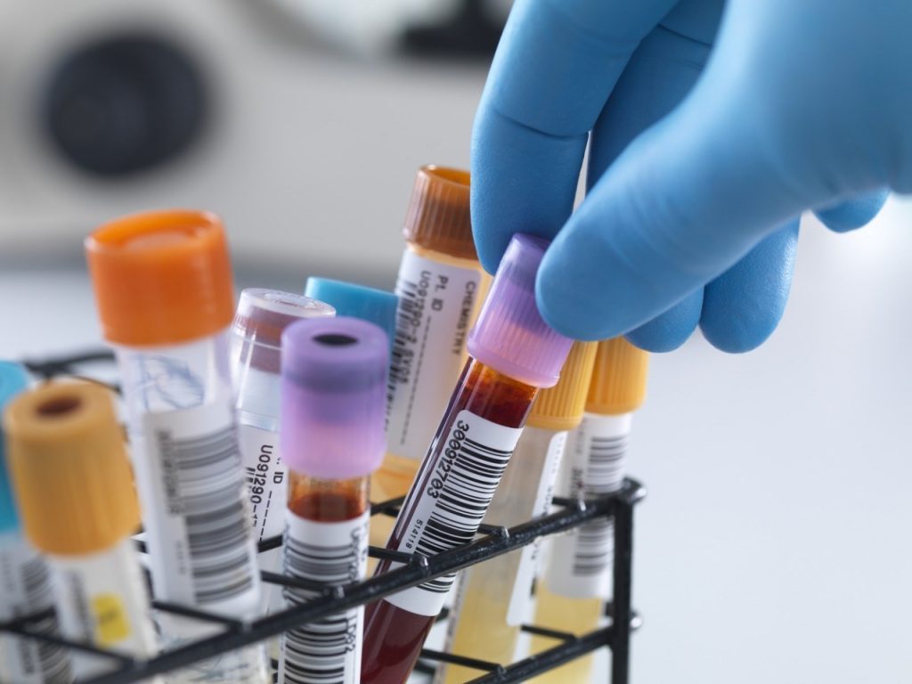 Сдать анализы в Анапе